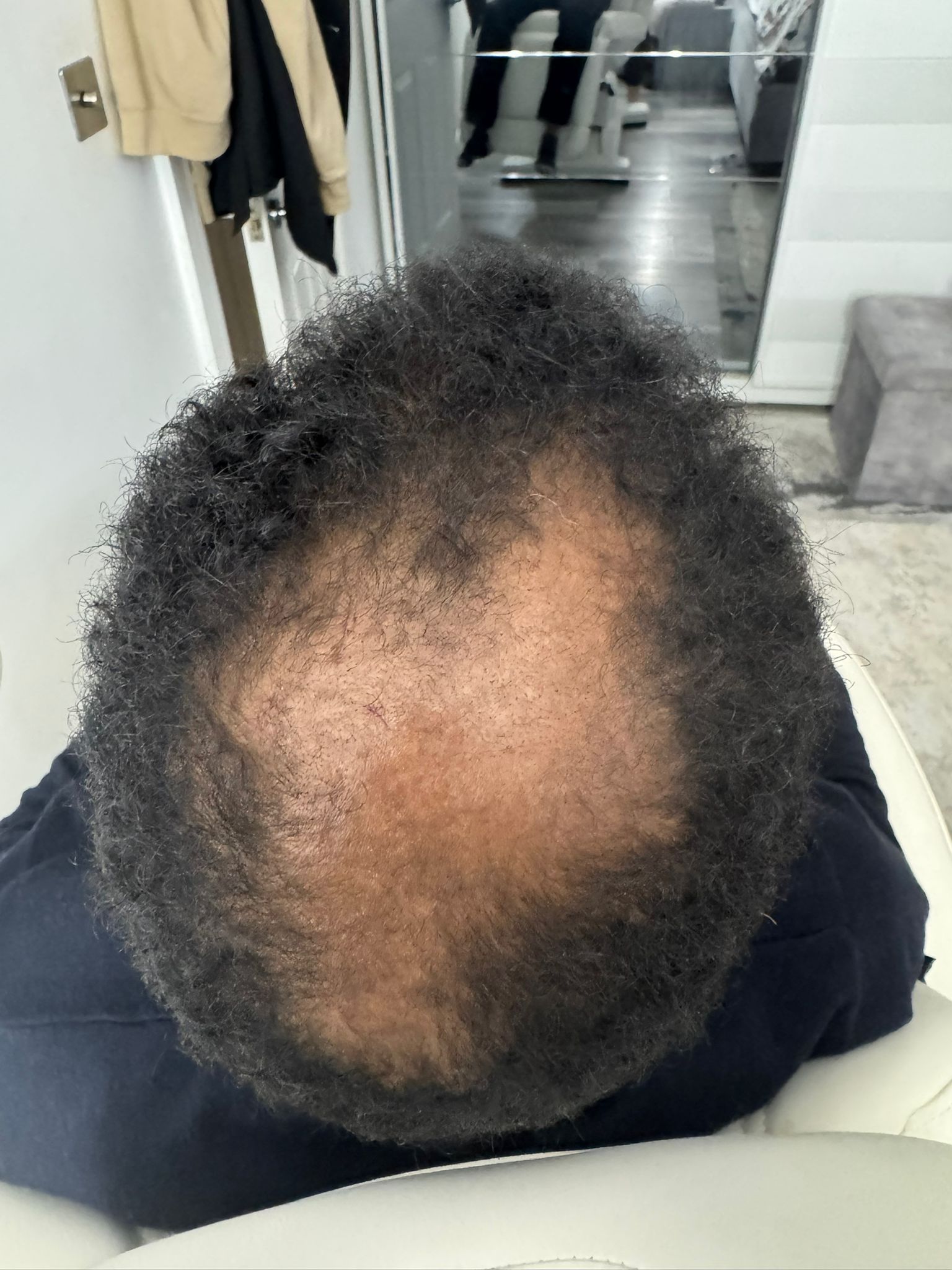 Hair Treatments · Scalp before