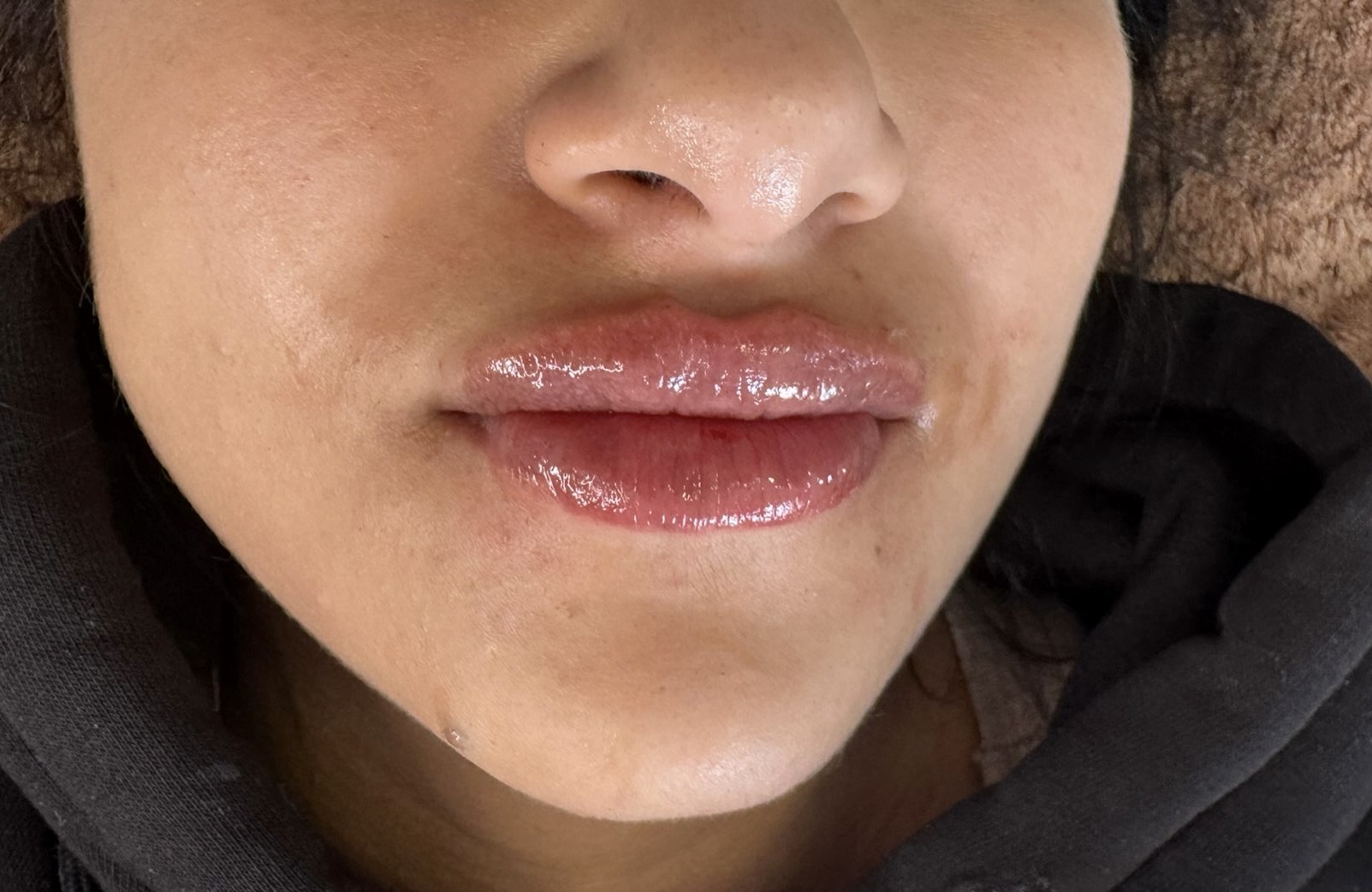 Lip enhancement result