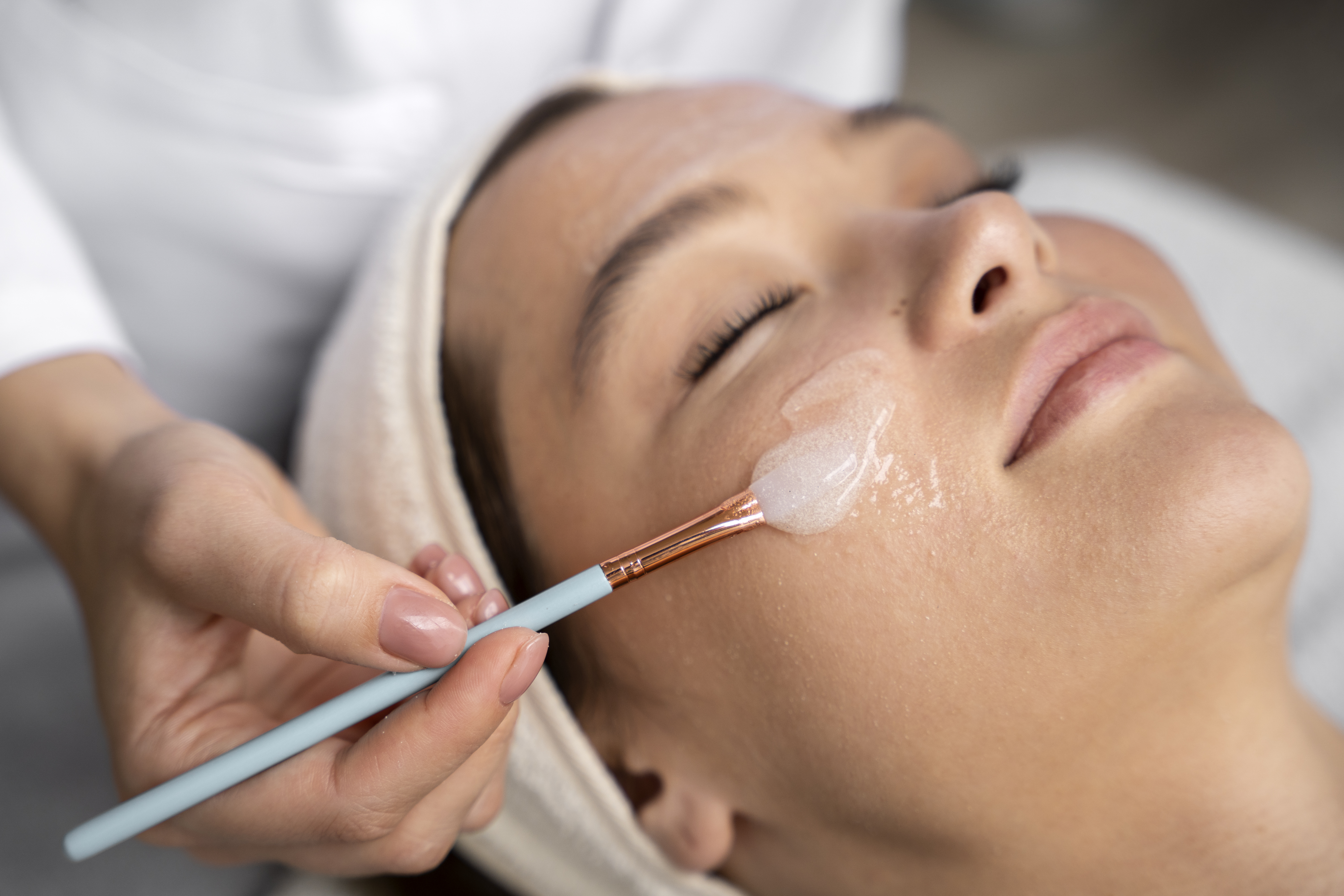 Chemical peel treatment